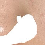 [<b>더러움주</b>의] 이거 블랙헤드야 모공이야?사진ㅇ