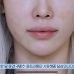 유튜버 뷰티<b>기기</b> 공구하는데 피부에 멍있음