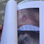 피해자입니다.(강남 낮 2시 8차선 횡단<b>보도</b>,가해자 남편이 변호사....