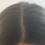 나 <b>탈모</b>아니지?
