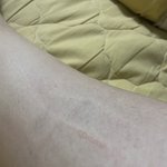 [댓글부탁해] 종아리 <b>마사</b>지기! 저만 문제있나요?