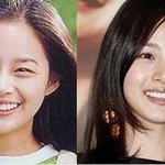 [댓글부탁해] 교정 다해놓고 자연<b>미인</b>인척 하는것도 솔직히 뻔뻔함