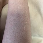 매일 샤워해도 다리에 이런 <b>각질</b>