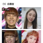 '<b>치아</b>교정을 성형처럼' 한국 연예인들