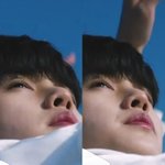 이거 코 수술 <b>흉터</b>야?