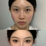 화장<b>전후</b> ㄹㅈㄷ다