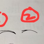 눈 <b>재수술</b> 확약서?