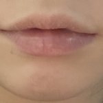 얘들아 턱 <b>길이</b> 어떻게 재는거야??