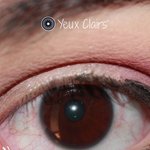 <b>오우</b> 눈동자 색을 회색으로 바꾸는 수술이 있네