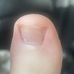 얘들아 이거 <b>내성</b>발톱임??