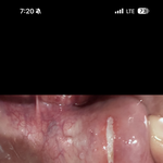 [어케생각해] 나 <b>입병</b> 레전드임 ..(혐주의)