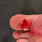 인천 <b>영종도</b> 네스트호텔 수영장에서 다쳤습니다...