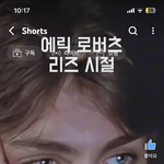 존 나 잘생겼는데 <b>차사고</b> 나서 성형함