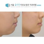 <b>본판</b>이 중요한 이유