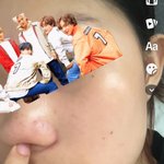 [도와주세요] 이런피부는 뭐 발라야 해?ㅠ