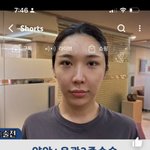 아니 이거 <b>양악</b> 전후 찐이야??
