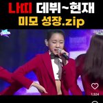 이거 미모 성장이 아니라 성형 <b>전후</b> 아니냐
