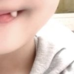 [드루와] 이런 <b>덧니</b> 있는 사람 없냐