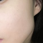 사각턱 ㅈㄴ스트레스 하