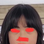 나 이렇게 생겼는데 어디 수술할지 추천좀