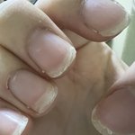 극혐..내 <b>손톱</b> 볼사람…