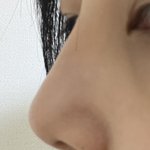 [댓글부탁해] 나 <b>콧대</b> 낮은편임?