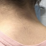 ㅇㄴ 목에 <b>잔털</b> 개많은데