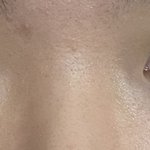 [댓글부탁해] 나 <b>함몰</b>눈임?