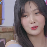 조이 <b>현재</b> 눈 근황