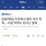 유명 치킨 프렌차이즈  <b>B사</b> 치킨에서 피 뚝뚝