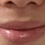 나 웃을때 비대칭 <b>개심</b>해