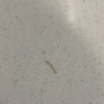 (혐) 결막염 걸렸는데 개큰 <b>눈곱</b> 뽑음