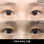 [댓글부탁해] 뒷트임 <b>밑</b>트임 뒤<b>밑</b>트임 할까ㅠㅠ