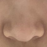 <b>복코</b> 수술할까