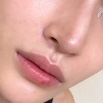 모공은 ㄹㅇ <b>시술</b>로도 힘든가보다