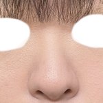 [댓글부탁해] 나 코<b>수술</b> 할까 말까