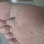 [댓글부탁해] 발사진 잇다)이거 <b>무좀</b>이야??이게 뭐지