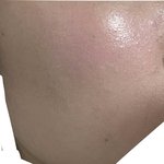 이거 피부 요철임? <b>좁쌀</b>임?