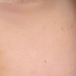 <b>반년</b>만에 피부 10창남