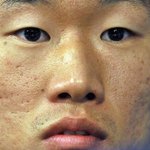 남자 피부 현실에서 이러면 여자들한테 호감주기 어렵나