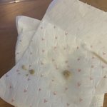 [댓글부탁해] 와 입 <b>위</b>에 편도결석 <b>다</b> 뺌!!!