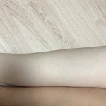 팔다리 색차이 <b>개오</b>반데