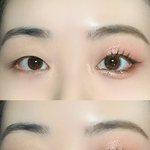 너넨 이런 눈이라면 <b>쌍수</b>함??
