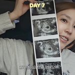 '<b>성민</b>' 김사은 "결혼 10년차에 임신...힘들게 노력해서 생긴...