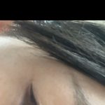 [댓글부탁해] 쌍수 어떻게 생각해?
