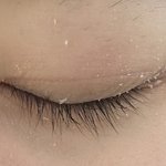 아니 나 눈 이거 왜이래?????1