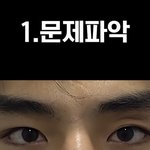 <b>이</b> 남자 <b>눈</b> 수술 왜 했을까 진심 개에바