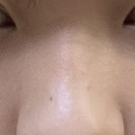 [드루와] 나 코 <b>붓기</b> <b>차이</b> ㄹㅈㄷ네