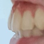 [혐주의] 나 <b>이빨</b> 많이 튀어나왔어?