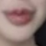 눈 코도 심각한데 입술이